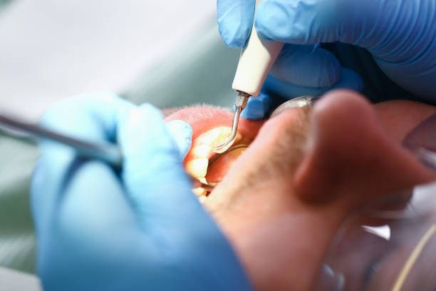 Best Broken or Cracked Tooth Emergency Dentist in Lafayette, TN