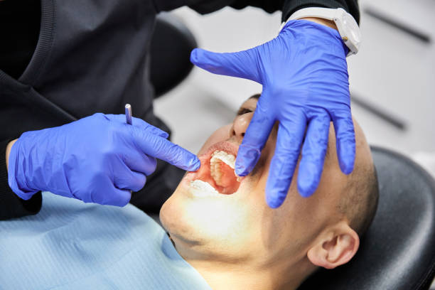 Best Emergency Dentist for Lost Fillings or Crowns in Lafayette, TN